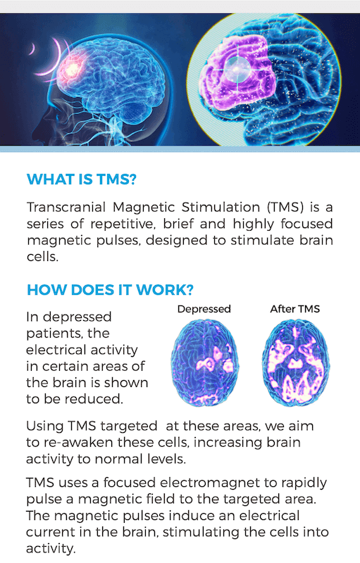 what is TMS Therapy